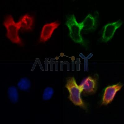 DIO1 Antibody - DF12382 staining Hela by IF/ICC.