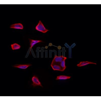 Drebrin Antibody - DF12388 staining Hela by IF/ICC.