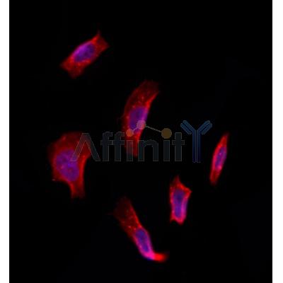 ETFDH Antibody - DF12395 staining Hela by IF/ICC.