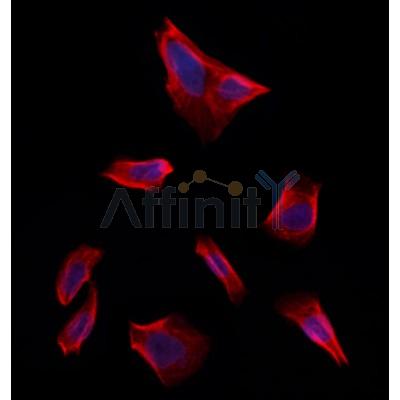 FBXO22 Antibody - DF12399 staining Hela by IF/ICC.