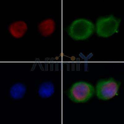 FOXO6 Antibody - DF12401 staining Hela by IF/ICC.