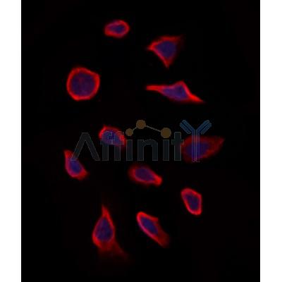 MMP28 Antibody - DF12423 staining Hela by IF/ICC.