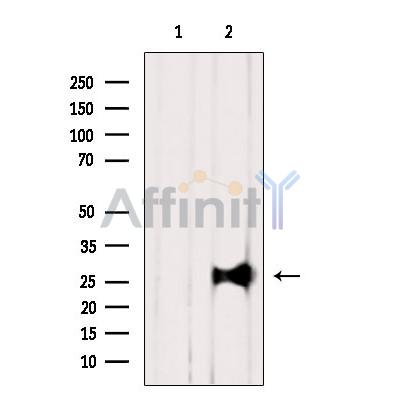 RAB12 Antibody - Western blot analysis of extracts from B16F10, using RAB12 Antibody.