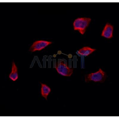 RAB14 Antibody - DF12460 staining Hela by IF/ICC.
