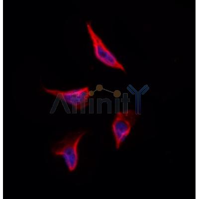 Rab3A Antibody - DF12461 staining Hela by IF/ICC.