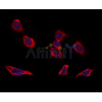 RIC8B Antibody - DF12465 staining Hela by IF/ICC.