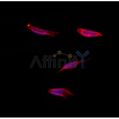 SGCG Antibody - DF12473 staining Hela by IF/ICC.