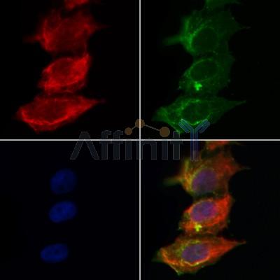 TBC1D23 Antibody - DF12484 staining Hela by IF/ICC.