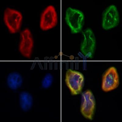 TCTN2 Antibody - DF12485 staining Hela by IF/ICC.