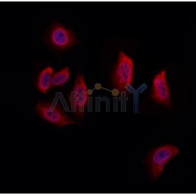 UFD1L Antibody - DF12494 staining Hela by IF/ICC.