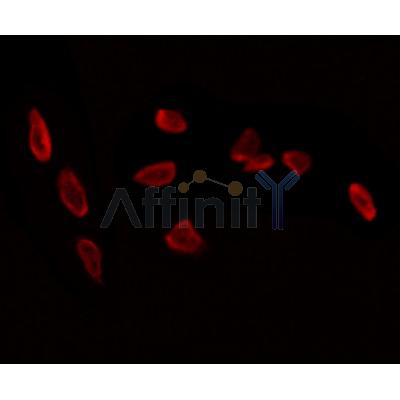 WDR18 Antibody - DF12502 staining Hela by IF/ICC.