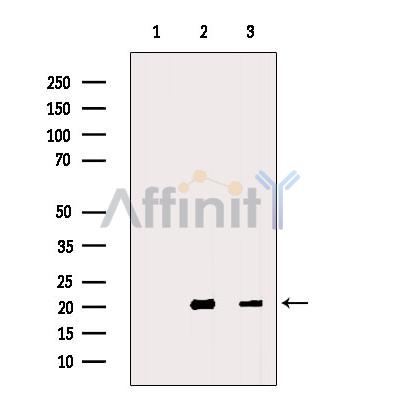 MFAP5 Antibody - Western blot analysis of extracts from various samples, using MFAP5 Antibody.