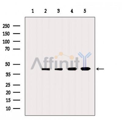 NRN1 Antibody - Western blot analysis of extracts from various samples, using NRN1 Antibody.