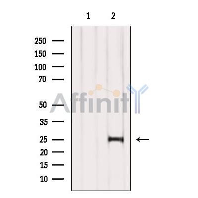COMMD5 Antibody - Western blot analysis of extracts from VERO, using COMMD5 Antibody.