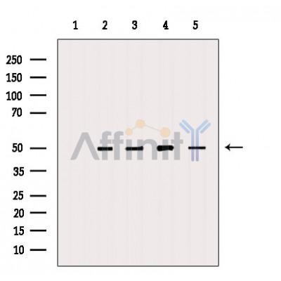 DMKN Antibody - Western blot analysis of extracts from various samples, using DMKN Antibody.