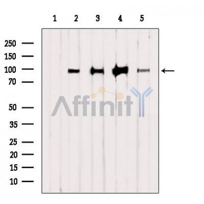 HELLS Antibody - Western blot analysis of extracts from various samples, using HELLS Antibody.