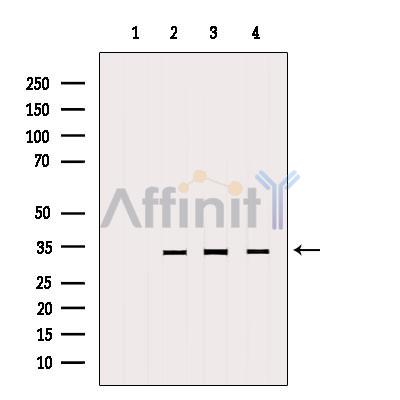 MTCH2 Antibody - Western blot analysis of extracts from various samples, using MTCH2 Antibody.