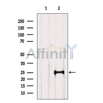 RABL3 Antibody - Western blot analysis of extracts from Rat  brain, using RABL3 Antibody.