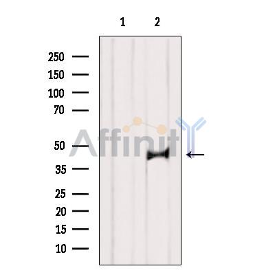 ST8SIA2 Antibody - Western blot analysis of extracts from VERO, using ST8SIA2-Specific Antibody.