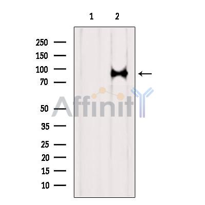 SUZ12 Antibody - Western blot analysis of extracts from B16F10, using SUZ12 Antibody.
