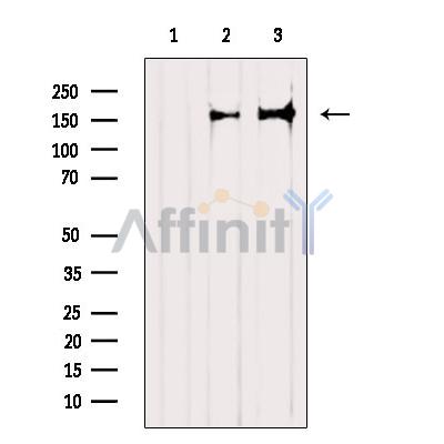 TALPID3 Antibody - Western blot analysis of extracts from various samples, using TALPID3 Antibody.