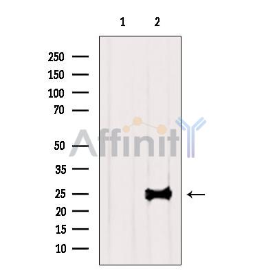TESC Antibody - Western blot analysis of extracts from Rat  brain, using TESC Antibody.
