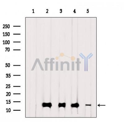 TIMM13 Antibody - Western blot analysis of extracts from various samples, using TIMM13 Antibody.