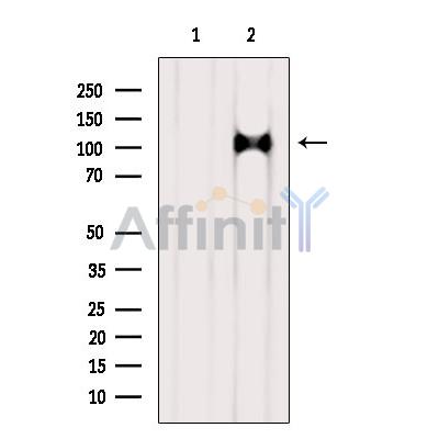 AP3D1 Antibody - Western blot analysis of extracts from Rat  brain, using AP3D1 Antibody.