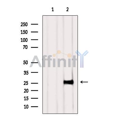 ARD1B Antibody - Western blot analysis of extracts from Rat  kidney, using ARD1B Antibody.