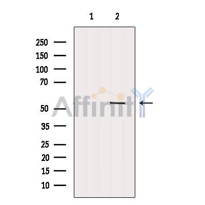 DDX6 Antibody - Western blot analysis of extracts from Huvec, using DDX6 Antibody.