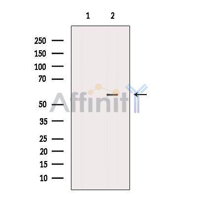 PTBP2 Antibody - Western blot analysis of extracts from Hybridoma cells, using PTBP2 Antibody.