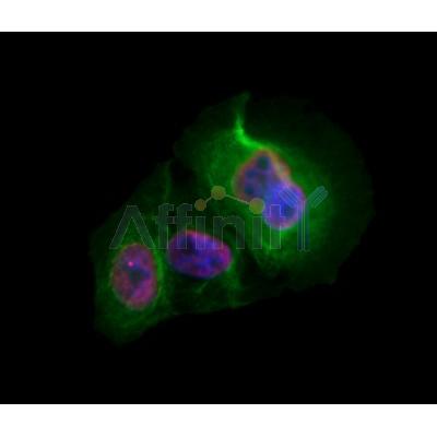 CDCA7 Antibody - DF3545 staining Hela by IF/ICC.
