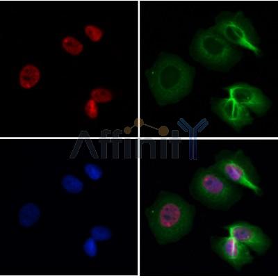 CDCA7 Antibody - DF3545 staining Hela by IF/ICC.