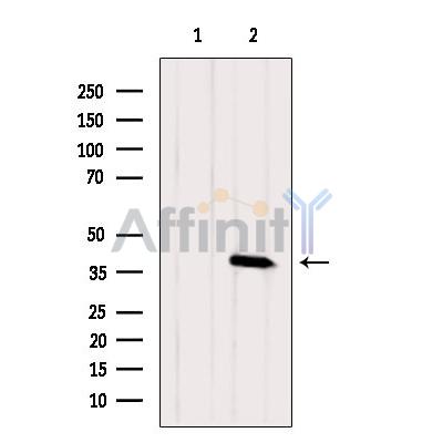 KCNK17 Antibody - Western blot analysis of extracts from Mouse  lung, using KCNK17 Antibody.