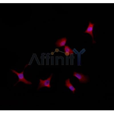 RABEP2 Antibody - DF4368 staining HepG2 by IF/ICC.