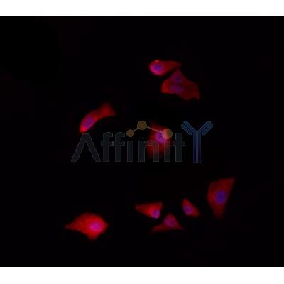 CHML Antibody - DF4369 staining HepG2 by IF/ICC.