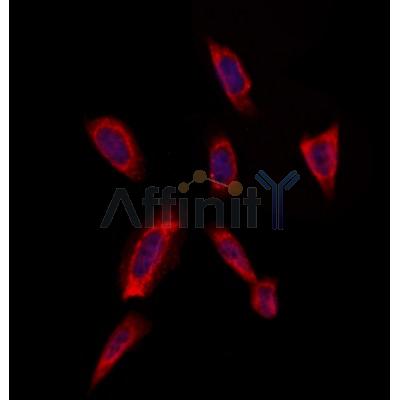 RAB20 Antibody - DF4396 staining Hela by IF/ICC.