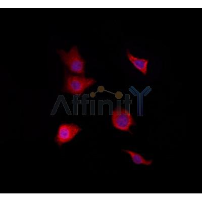 RAB38 Antibody - DF4404 staining HepG2 by IF/ICC.