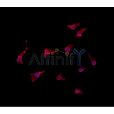 SLC28A2 Antibody - DF4522 staining HepG2 by IF/ICC.