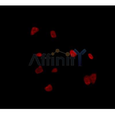 RALY Antibody - DF4657 staining HepG2 by IF/ICC.