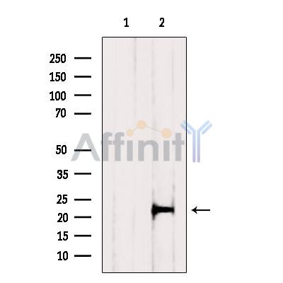 BID Antibody - Western blot analysis of extracts from PC12, using BID Antibody.