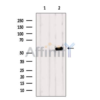 OLFM1 Antibody - Western blot analysis of extracts from VERO, using OLFM1 Antibody.