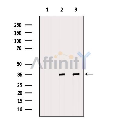 FBL Antibody - Western blot analysis of extracts from various samples, using FBL Antibody.