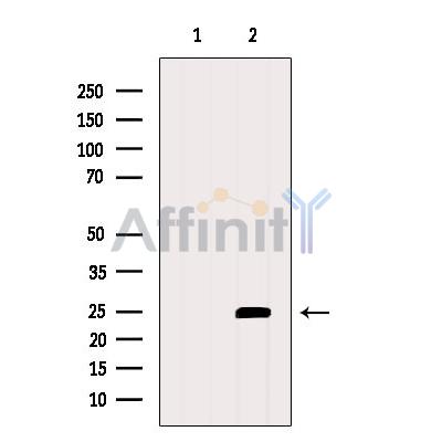 EBAG9 Antibody - Western blot analysis of extracts from Rat  heart, using EBAG9 Antibody.