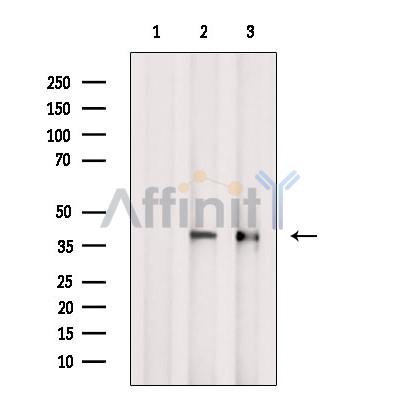 PCBP2 Antibody - Western blot analysis of extracts from various samples, using PCBP2 Antibody.