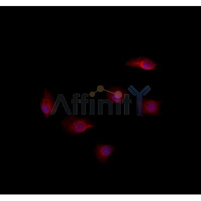 RAB35 Antibody - DF8710 staining Hela by IF/ICC.