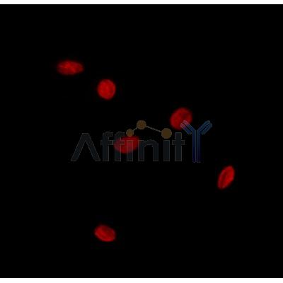 SOX12 Antibody - DF8757 staining HepG2 by IF/ICC.