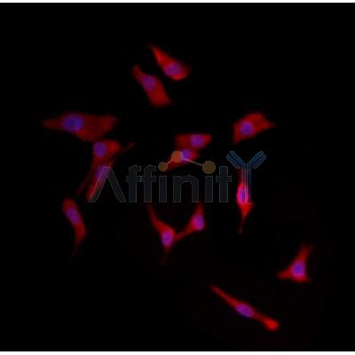 KITH_HHV1S Antibody - DF8779 staining HepG2 by IF/ICC.