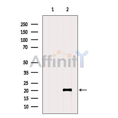 KKLC1 Antibody - Western blot analysis of extracts from VERO, using KKLC1 Antibody.