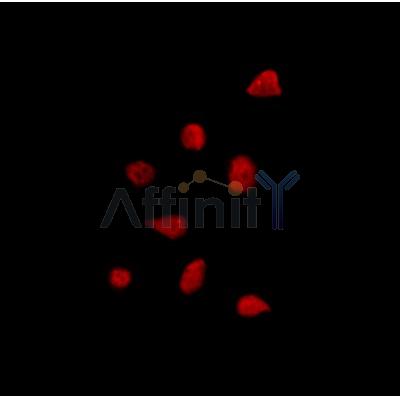 PER1 Antibody - DF9080 staining HepG2 by IF/ICC.
